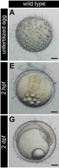 Unfertilized medaka egg with scattered oil droplets above a 2-hour fertilized egg with a cell cap and a 2-day embryo with one oil drop